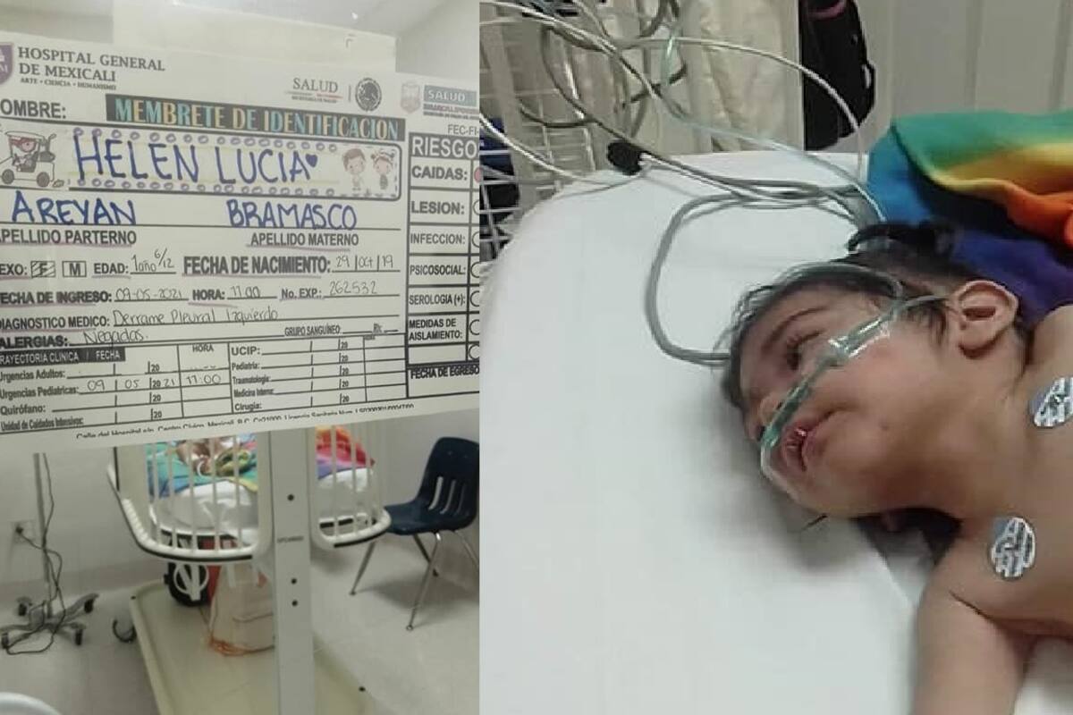 Crecen los gastos para salvar pulmón de la pequeña Helen