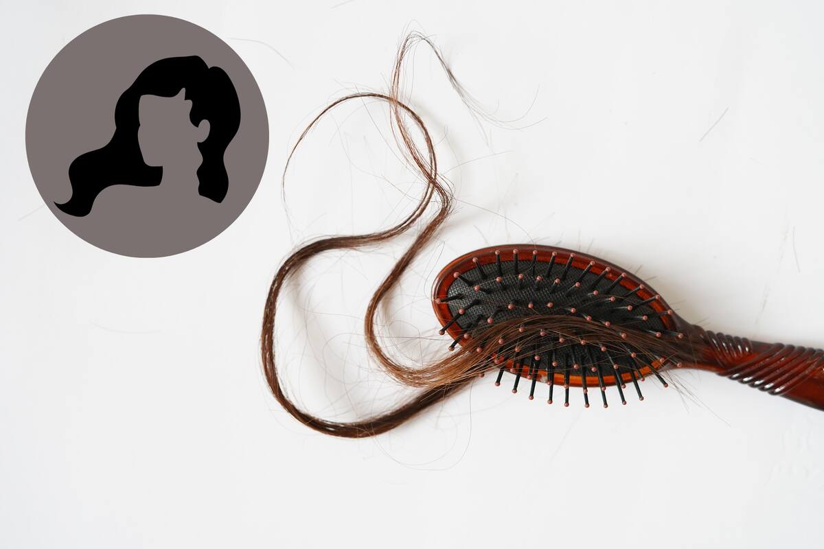¿Qué vitaminas pueden ayudar con la alopecia?