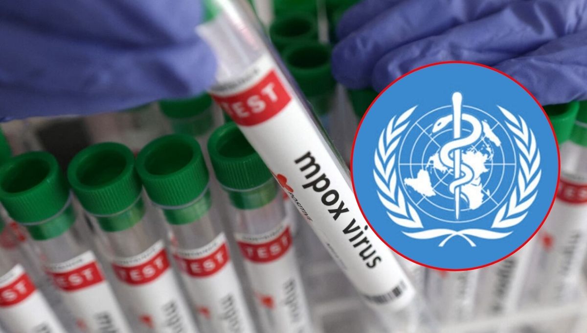 OMS mantiene la alerta mundial tras aumento de casos de Mpox