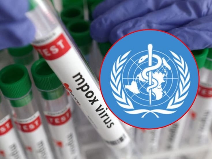 Detectan nueva cepa recombinante de viruela símica; la OMS piden reforzar vigilancia en todo el mundo ¿Qué tan peligrosa es esta variante?