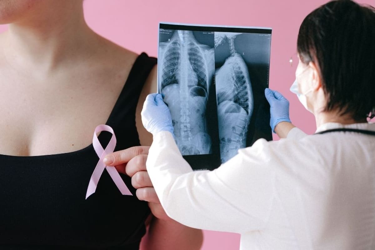 Muertes por cáncer de mama aumentan 18.6% en un año en Sonora; en México, el tratamiento cuesta más del doble que hace cinco años y la detección tardía puede prolongarlo