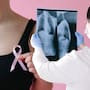 Muertes por cáncer de mama aumentan 18.6% en un año en Sonora; en México, el tratamiento cuesta más del doble que hace cinco años y la detección tardía puede prolongarlo