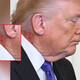 ¿Qué le pasa a Trump en el cuello? Captan erupción que se ha vuelto viral