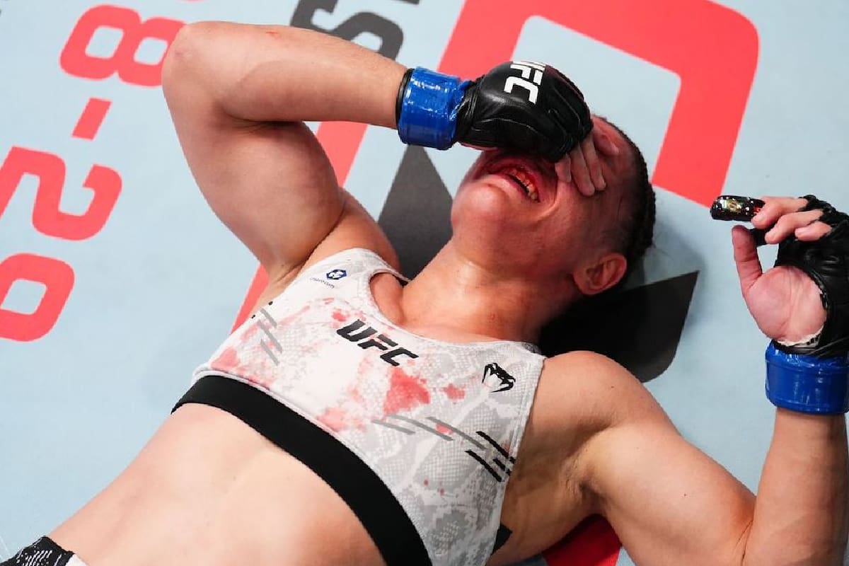 Peleadora de UFC reveló las lesiones faciales que sufrió tras recibir cabezazos de su rival
