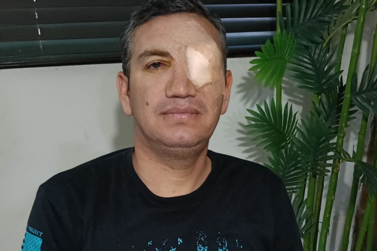 Familia organiza venta de barbacoa para cubrir gastos médicos de César Tánori tras operaciones oculares