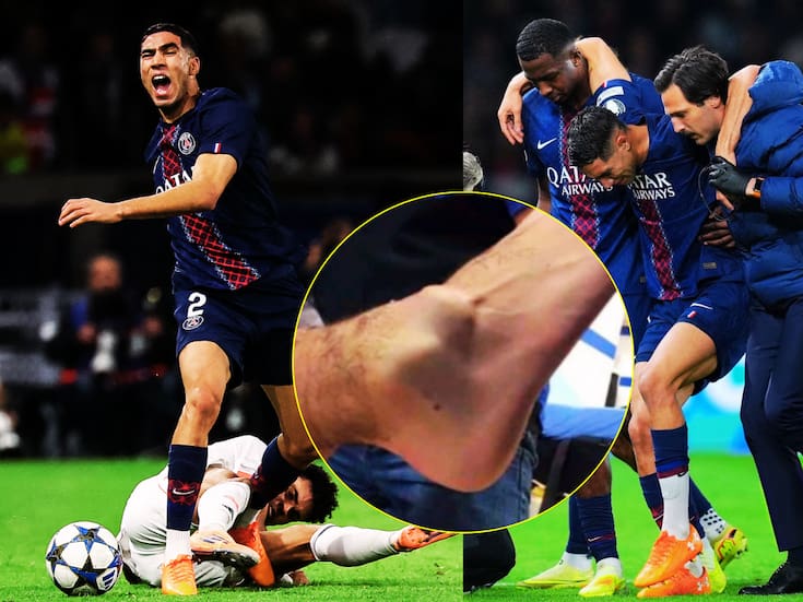 ¿Cuánto tiempo estará fuera Archraf Hakimi luego de la horrible lesión que sufrió en la Champions?