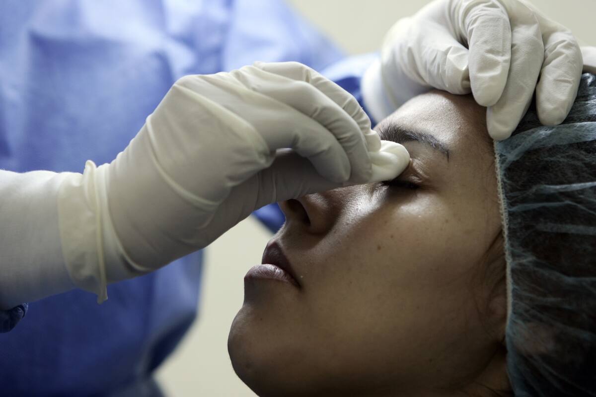 ¡Cuidado! Esto podría pasarte si te tatúas la ceja y rellenas los labios constantemente