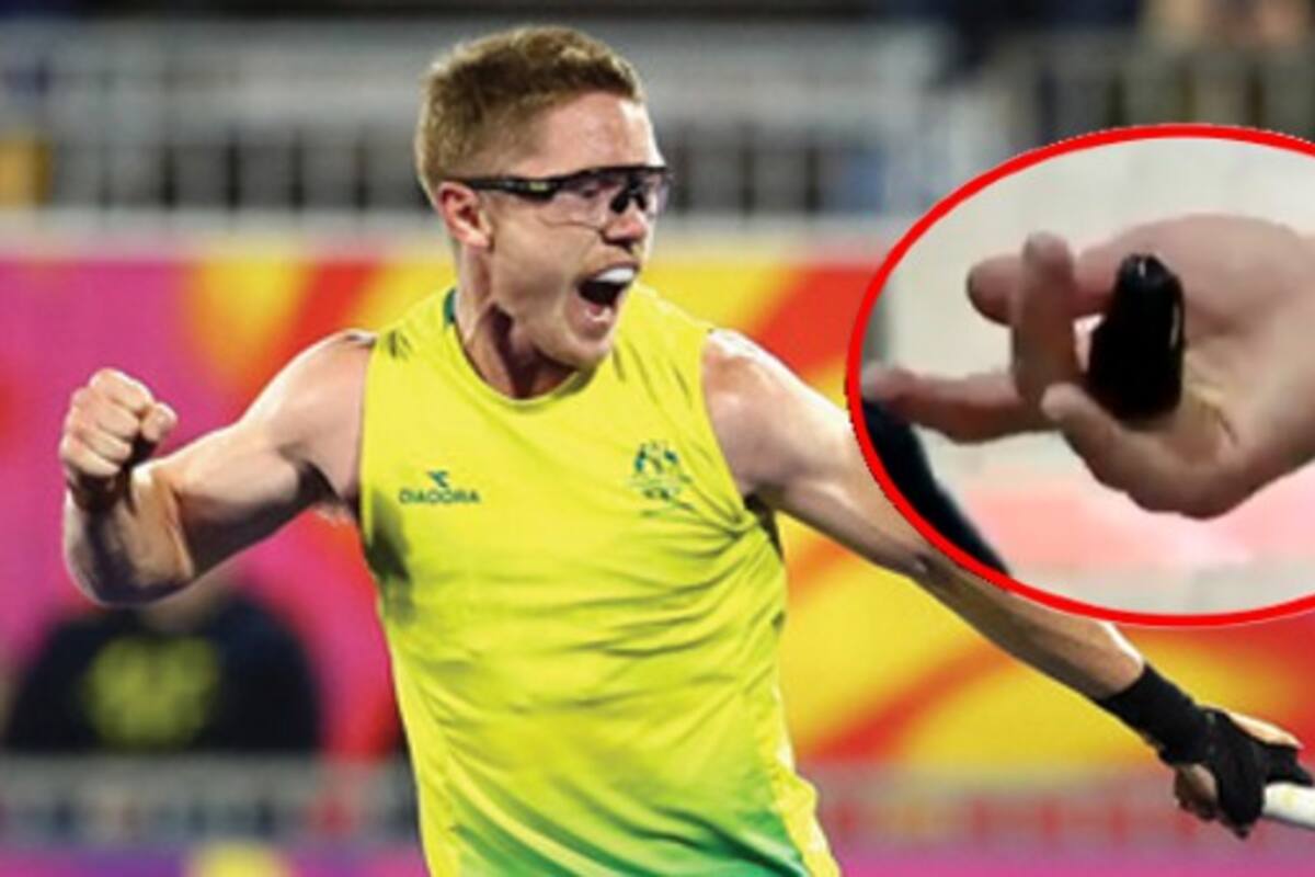 Sacrificó parte de su mano con tal de ir a los Juegos Olímpicos