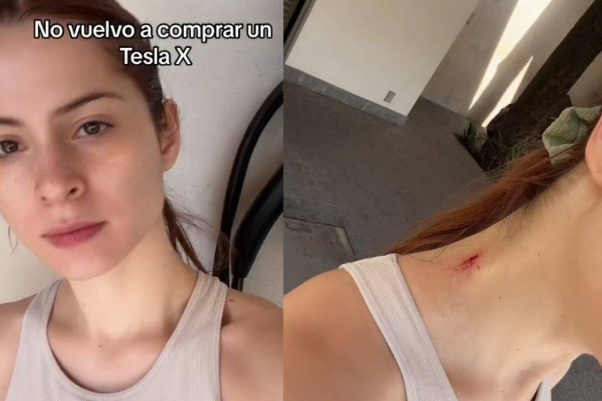 Mujer asegura que no se volverá a comprar un Tesla X tras golpearse con una de las puertas