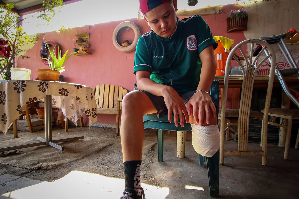 Apoyan cachanillas a Jorge, el joven que perdió un pie