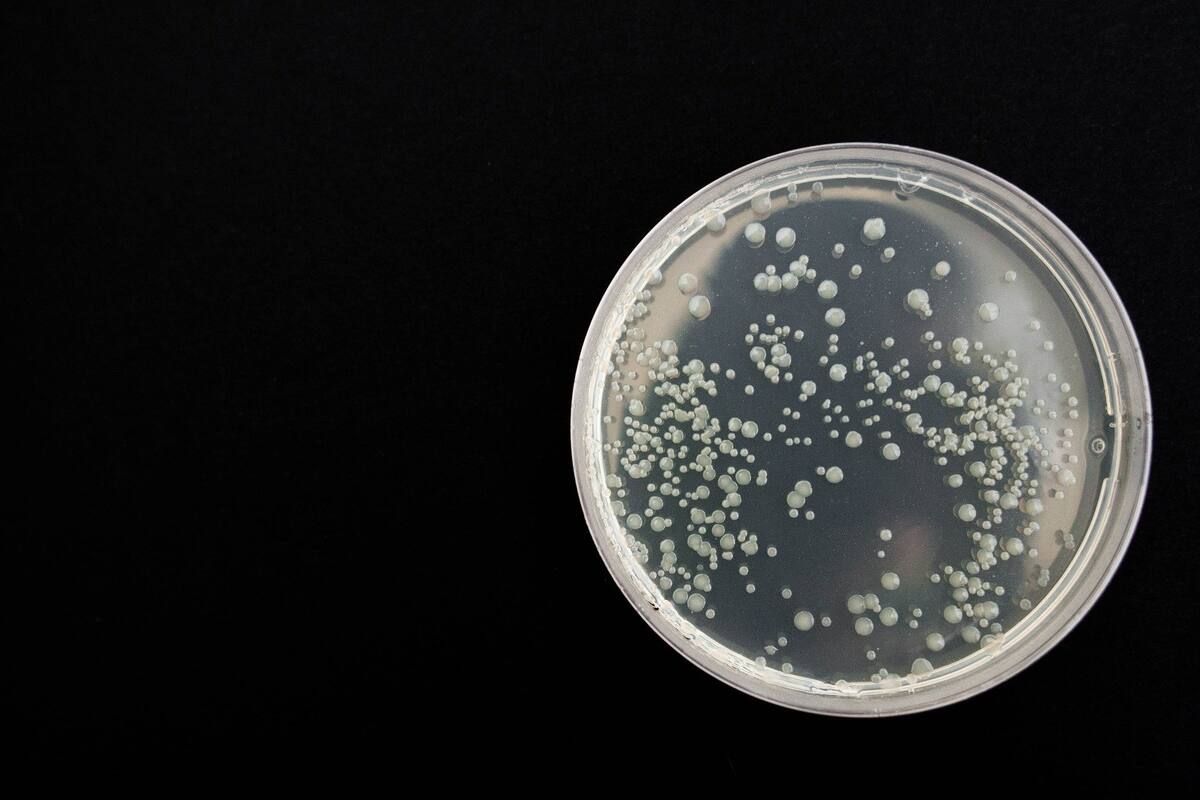Descubren que una bacteria desarrolló su propio sistema de fotosíntesis