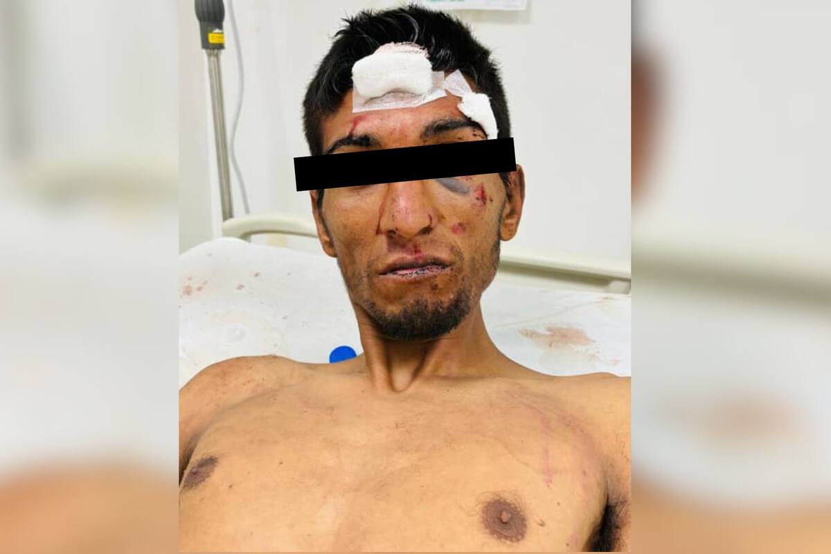 Hieren gravemente a hombre tras privación de su libertad