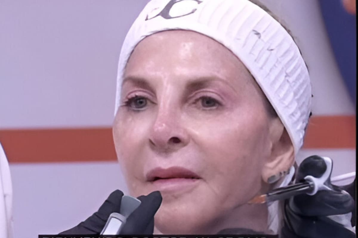 Shanik Berman se somete a procedimiento estético previo a La Casa de los Famosos México