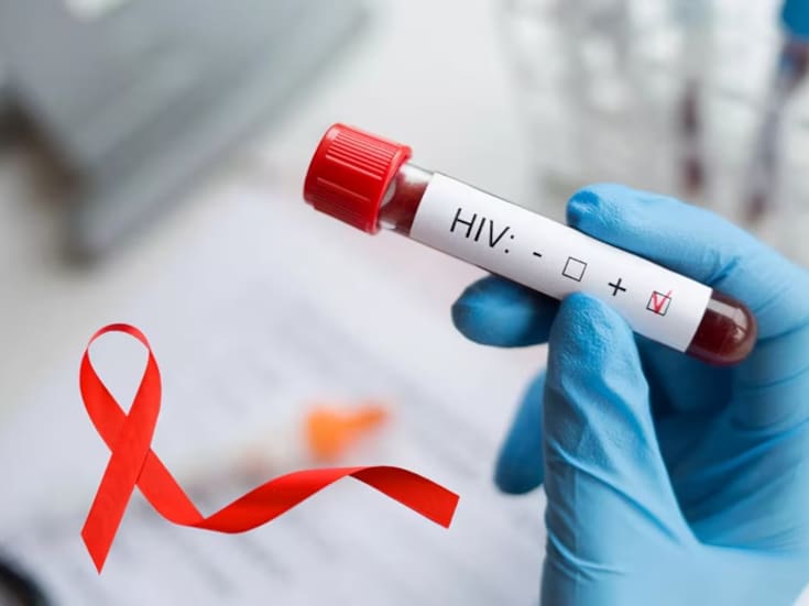 Bajan en BC nuevos casos de VIH/SIDA
