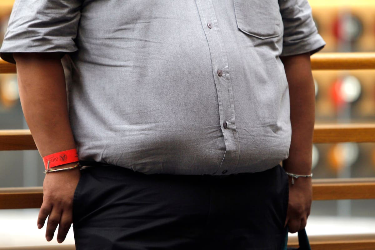Fotografía de archivo fechada el 15 de agosto de 2017 que muestra una persona con obesidad en una calle en la Ciudad de México (México). EFE/Sáshenka Gutiérrez /Archivo