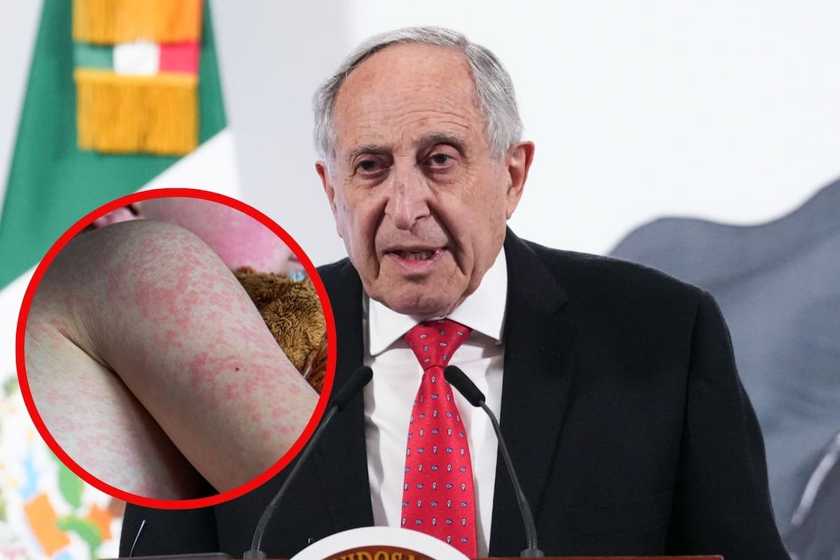 Alerta por brote de sarampión en México: más de mil 900 casos confirmados en 17 estados