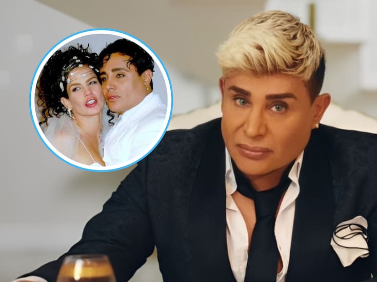 Eduardo Antonio, ex de Niurka, presume nuevo look tras cirugía de ojos y se declara “mulato de ojos verdes”