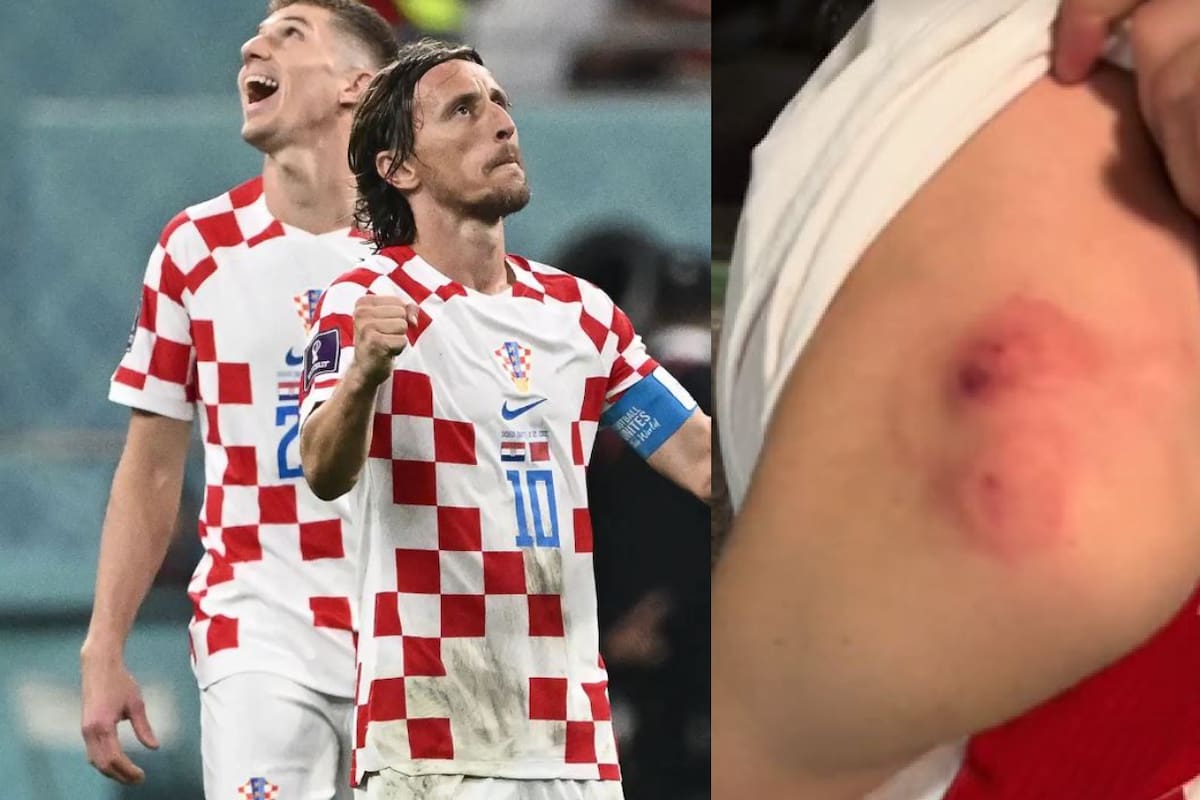 VIDEO | Mujer ataca a mordidas a un aficionado por la camiseta de un futbolista de Croacia