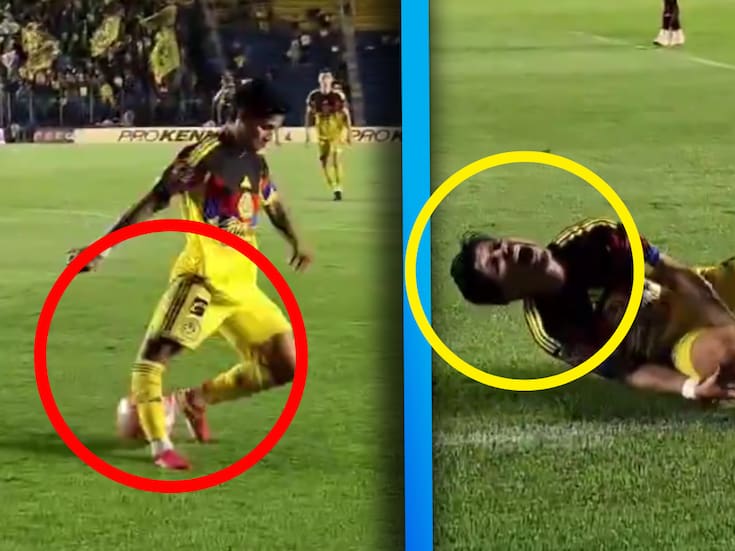 Víctor Dávila sufre aparatosa lesión de rodilla en el América vs FC Juárez y es trasladado al hospital (VIDEO)
