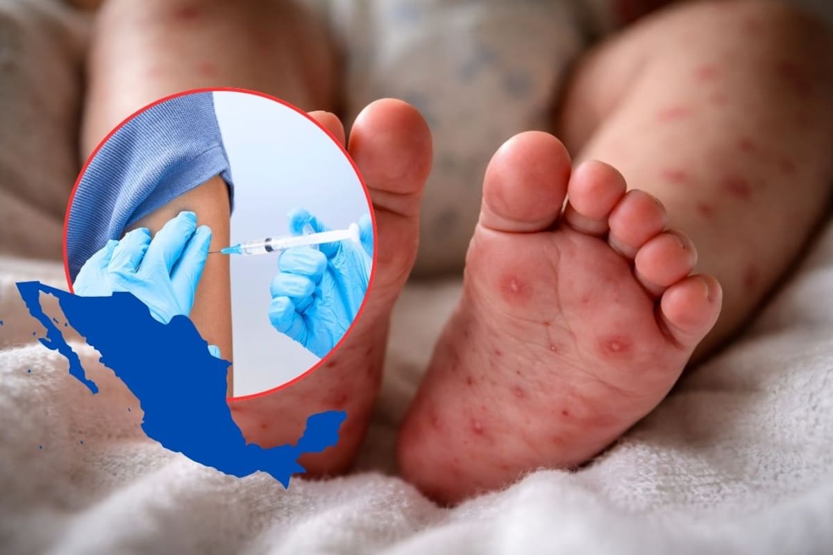 Muere menor de 2 años por sarampión en Guerrero; Salud confirma primera defunción en Cochoapa el Grande y refuerza vacunación