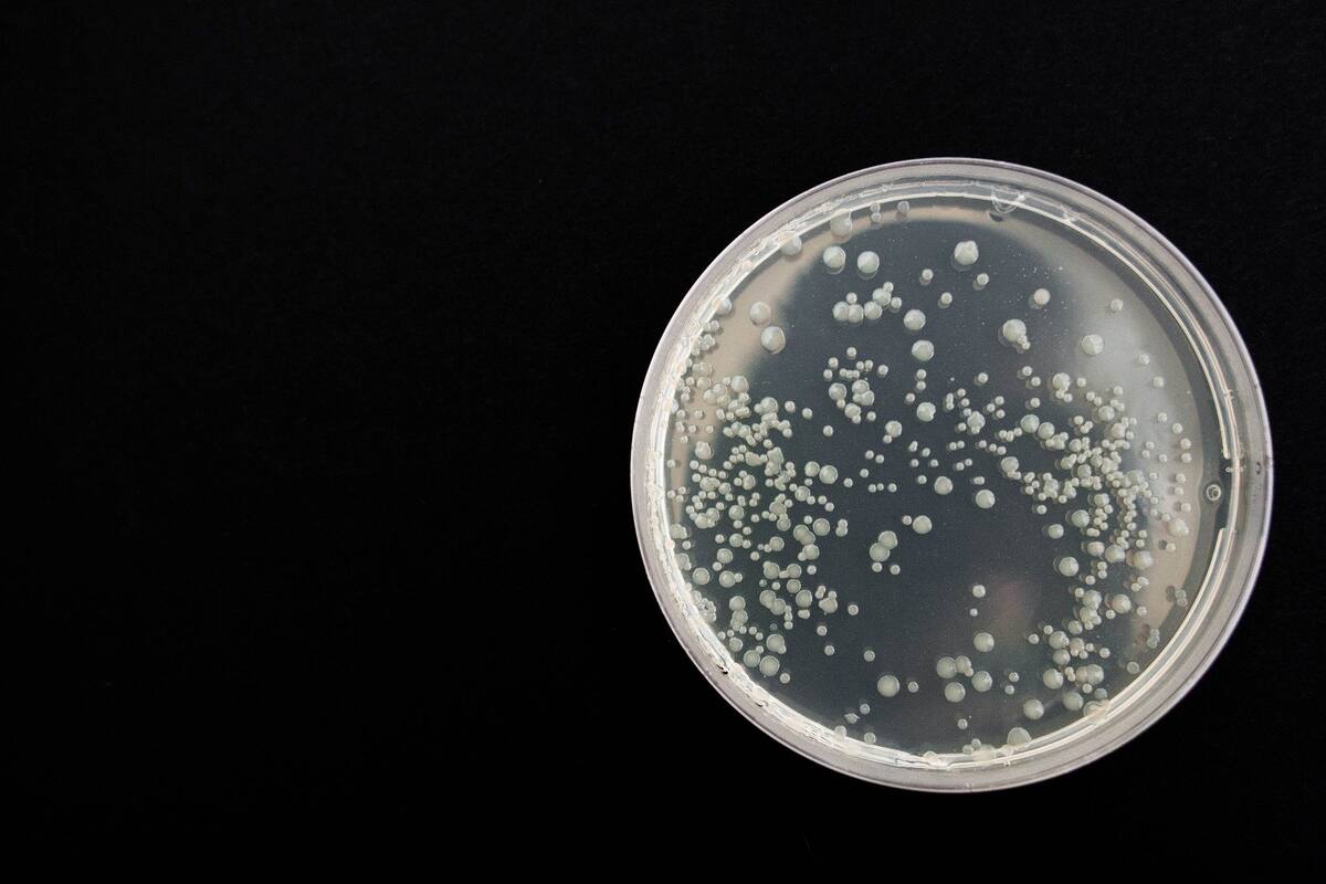 Bacteria que pueden causar infecciones mortales son halladas en el suelo y el agua de EU por primera vez