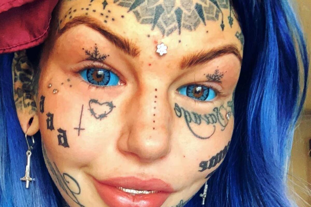 Amber Luke se quedó ciega 3 semanas tras inyectarse los ojos con tinta