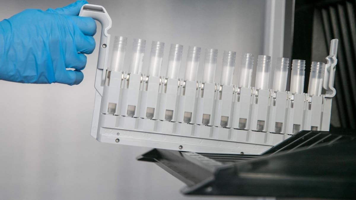 Científicos del Reino Unido logran remisiones prolongadas en pacientes con leucemia T gracias a la nueva terapia genética y que ha permitido eliminar un cáncer considerado casi incurable