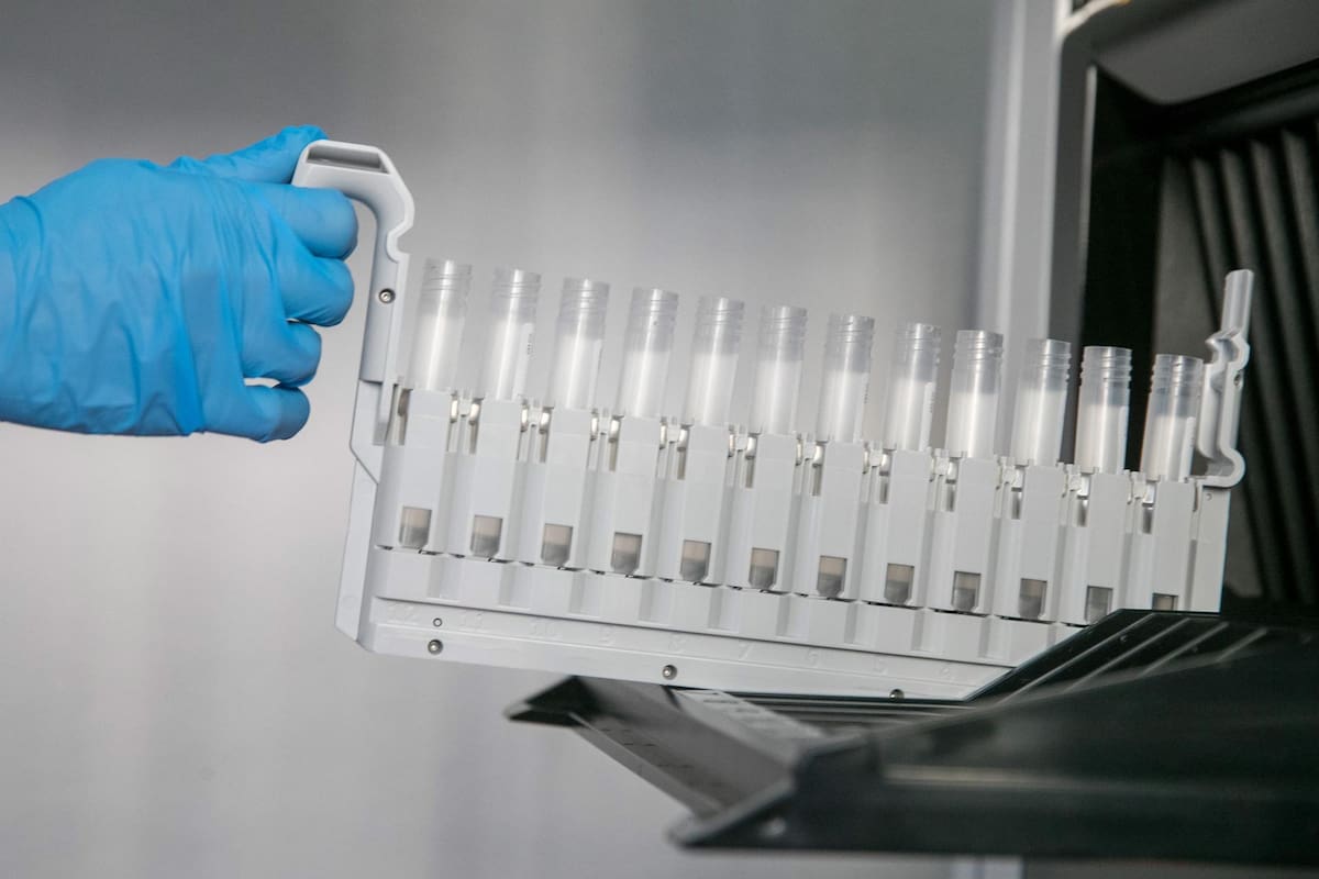 Científicos del Reino Unido logran remisiones prolongadas en pacientes con leucemia T gracias a la nueva terapia genética y que ha permitido eliminar un cáncer considerado casi incurable