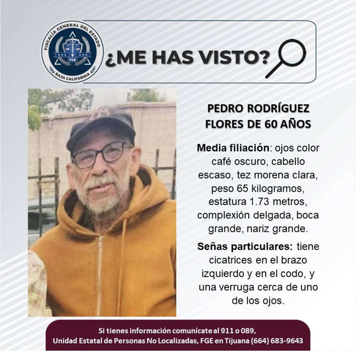 El desaparecido tiene cicatrices en el brazo izquierdo y en el codo, y una verruga cerca de uno de los ojos.