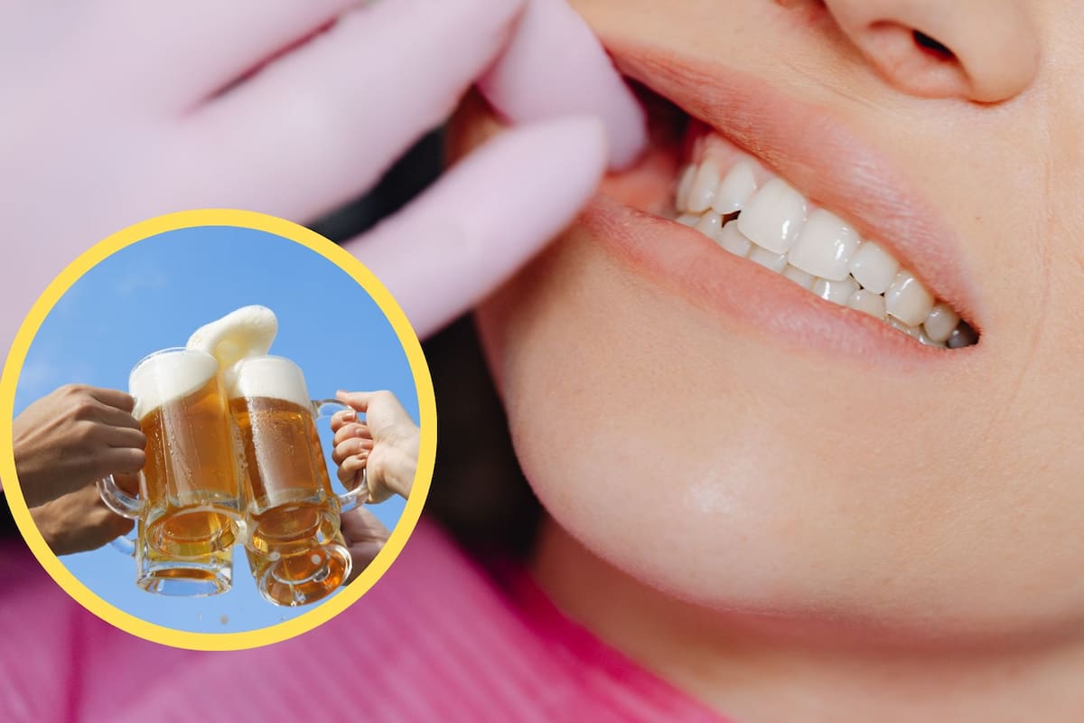 Efectos del alcohol en los dientes