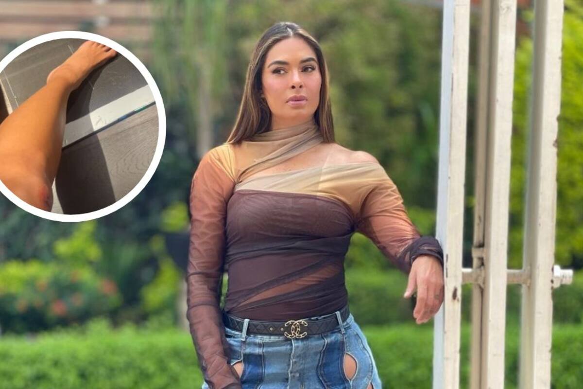 Galilea sufre una caída y teme por posible fractura