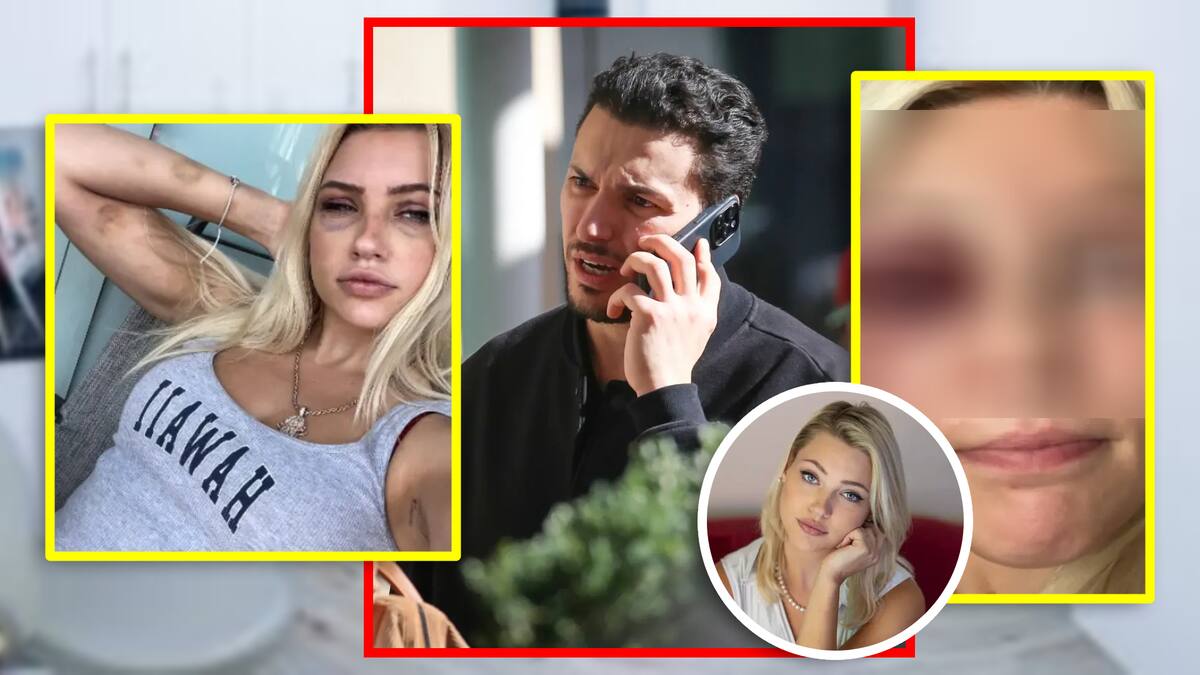 Modelo acusa a exnovio de 9 meses de golpearla salvajemente y tratar sus lesiones de forma clandestina en su clínica; la trataba como ‘esclava sexual’, dice la demanda