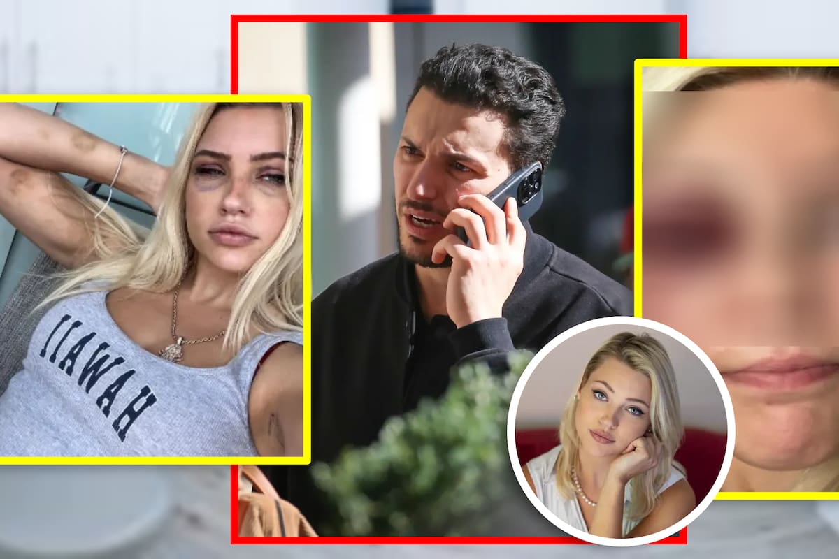 Modelo acusa a exnovio de 9 meses de golpearla salvajemente y tratar sus lesiones de forma clandestina en su clínica; la trataba como ‘esclava sexual’, dice la demanda