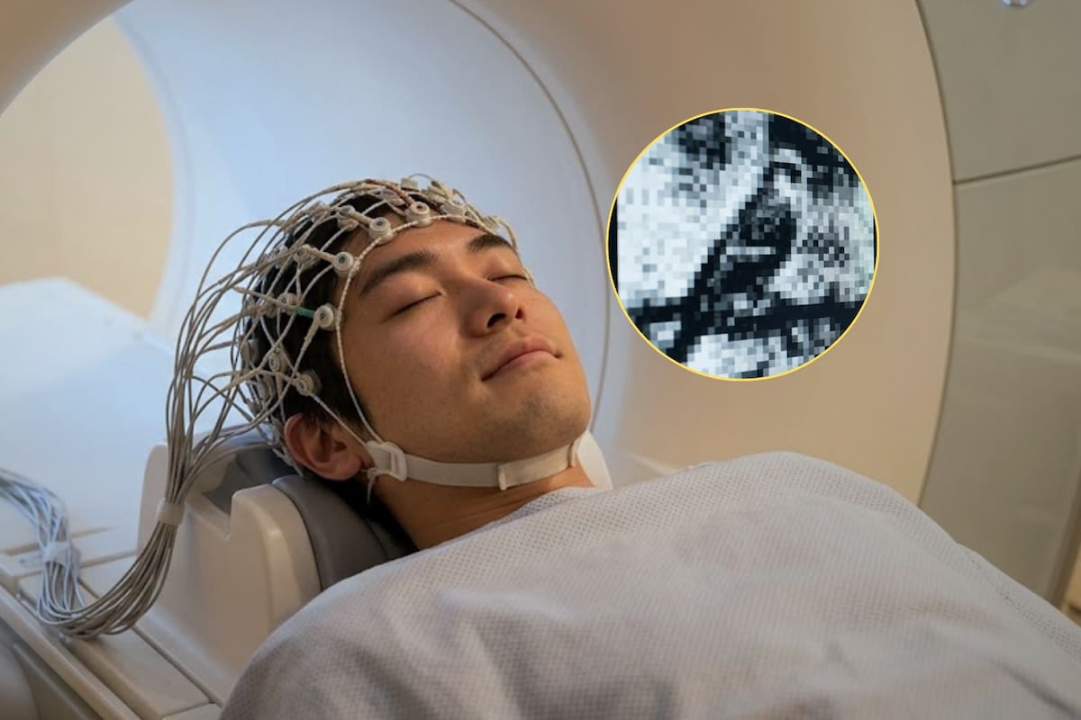 Científicos lograron obtener “grabaciones” de los sueños con inteligencia artificial y planean usar la decodificación de ondas cerebrales en el diagnóstico de traumas y trastorno de estrés postraumático, pero el avance tecnológico está obligando a los expertos a crear leyes de protección para la mente humana
