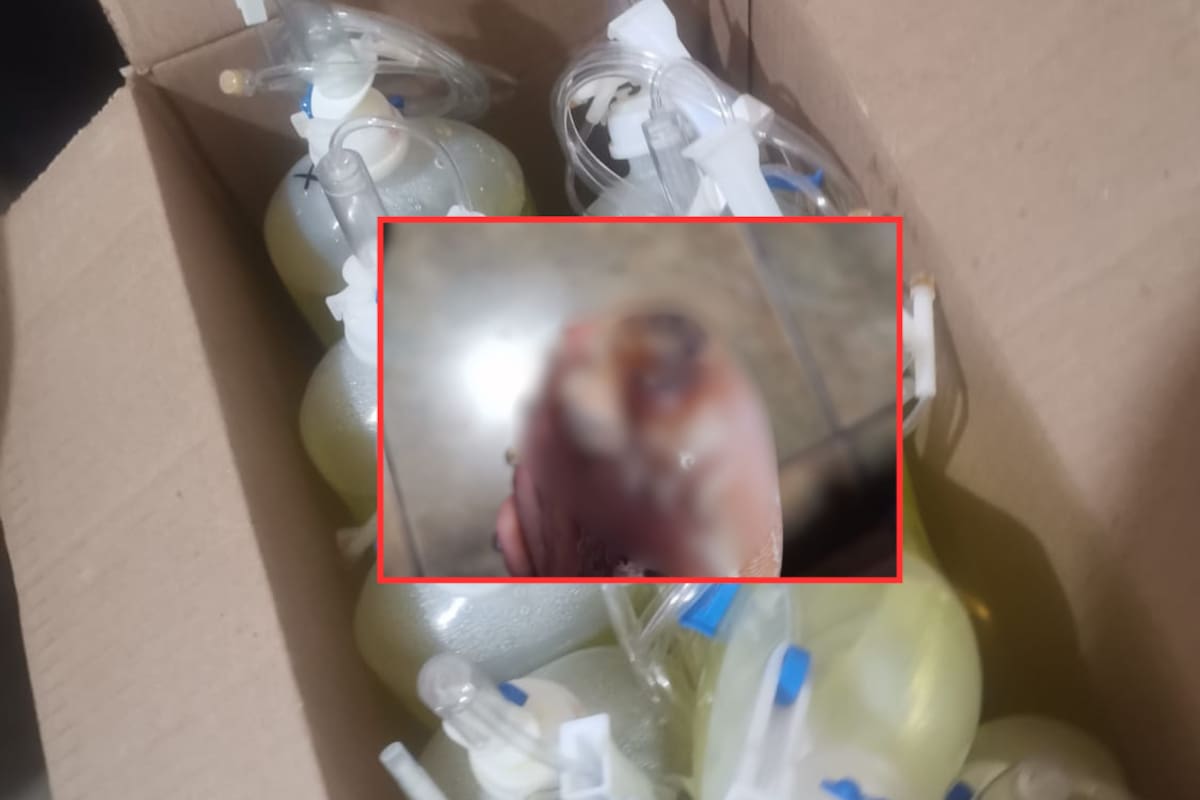 Guaymense se aplica 14 sueros vitaminados y se complica su salud