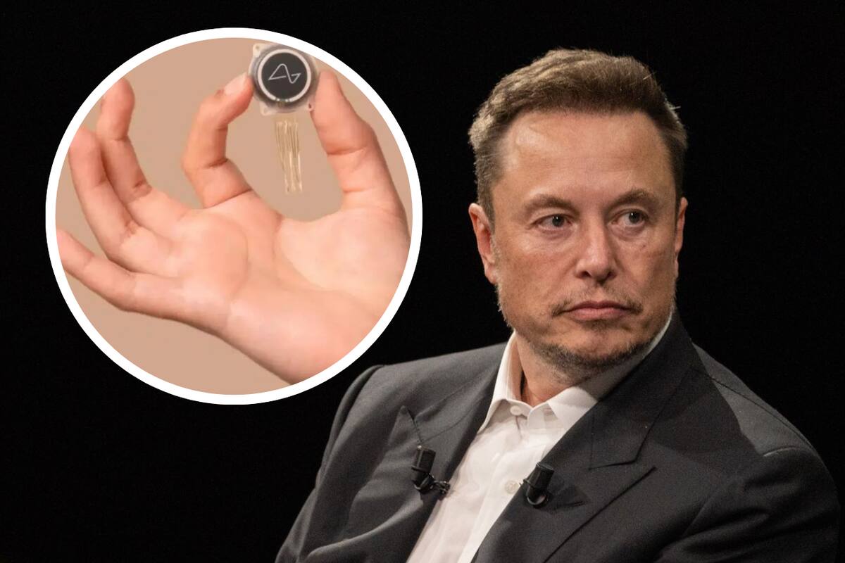 ¿Qué falta para que “Neuralink” pueda funcionar en México y el mundo?