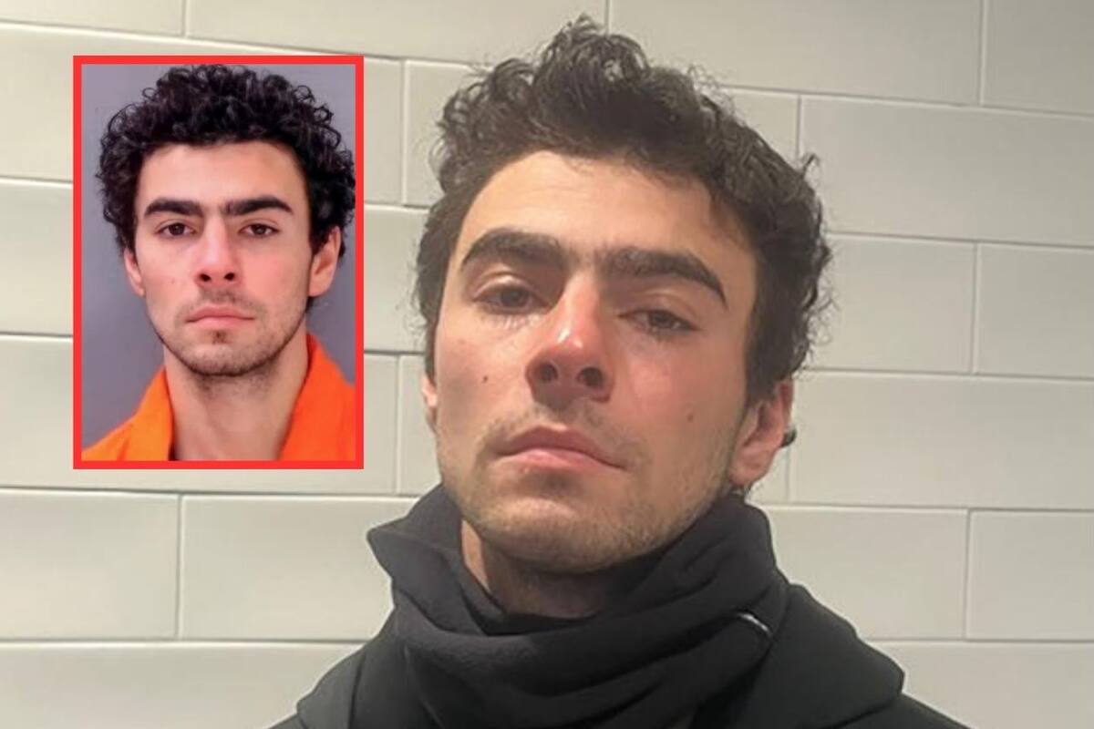 En casos avanzados, la espondilolistesis puede causar deformidades de la columna, como hiperlordosis (curvatura exagerada) o cifosis (espalda redondeada).