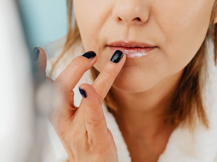 ¿Por qué se resecan los labios en invierno? Y cómo protegerlos, según expertos