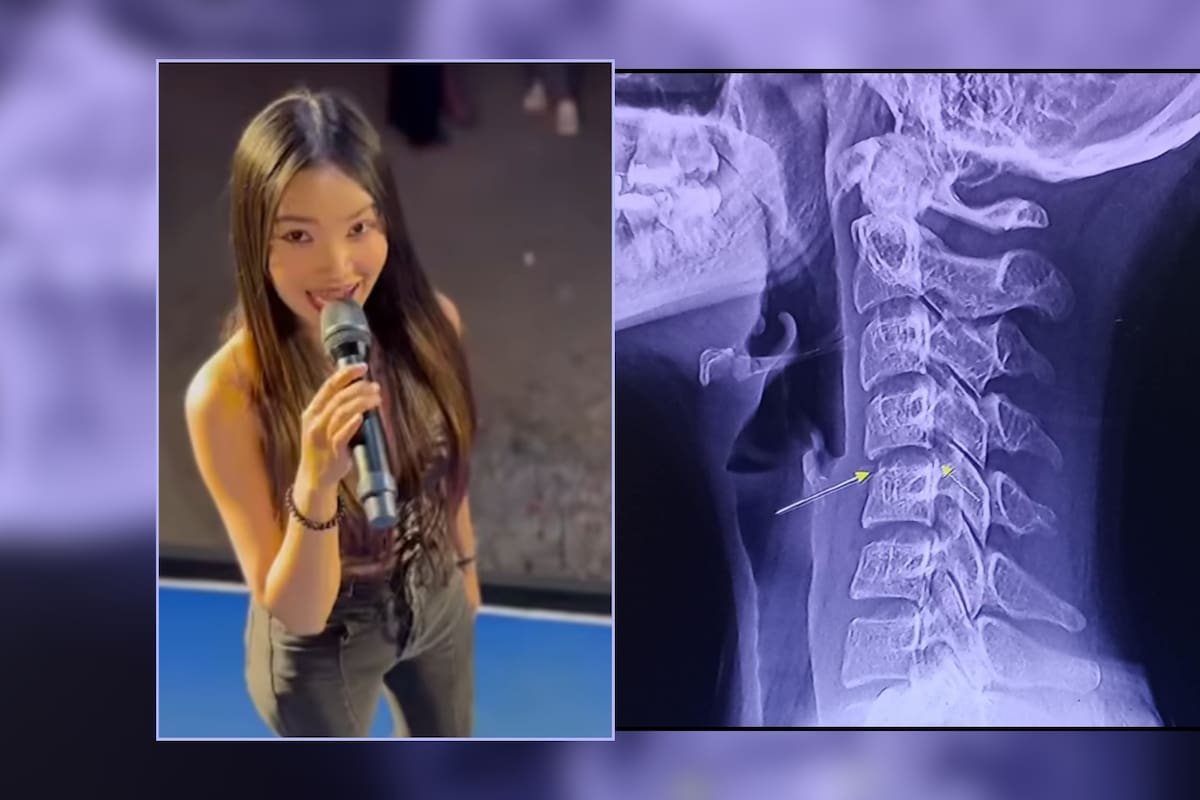 Muere joven cantante tras recibir un masaje para tratar dolor de hombros y genera debate sobre causa de muerte: ¿Qué fue lo que pasó?