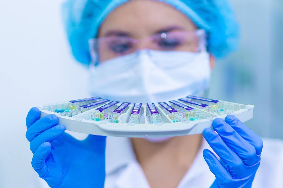 90% del millón de pruebas por Covid-19 hechas en Alemania han dado negativo