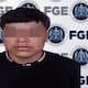 Golpea a su pareja en el rostro y le causa grave lesión