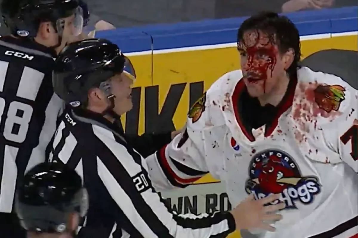 ¿Por qué están permitidas las peleas en los juegos de hockey sobre hielo?