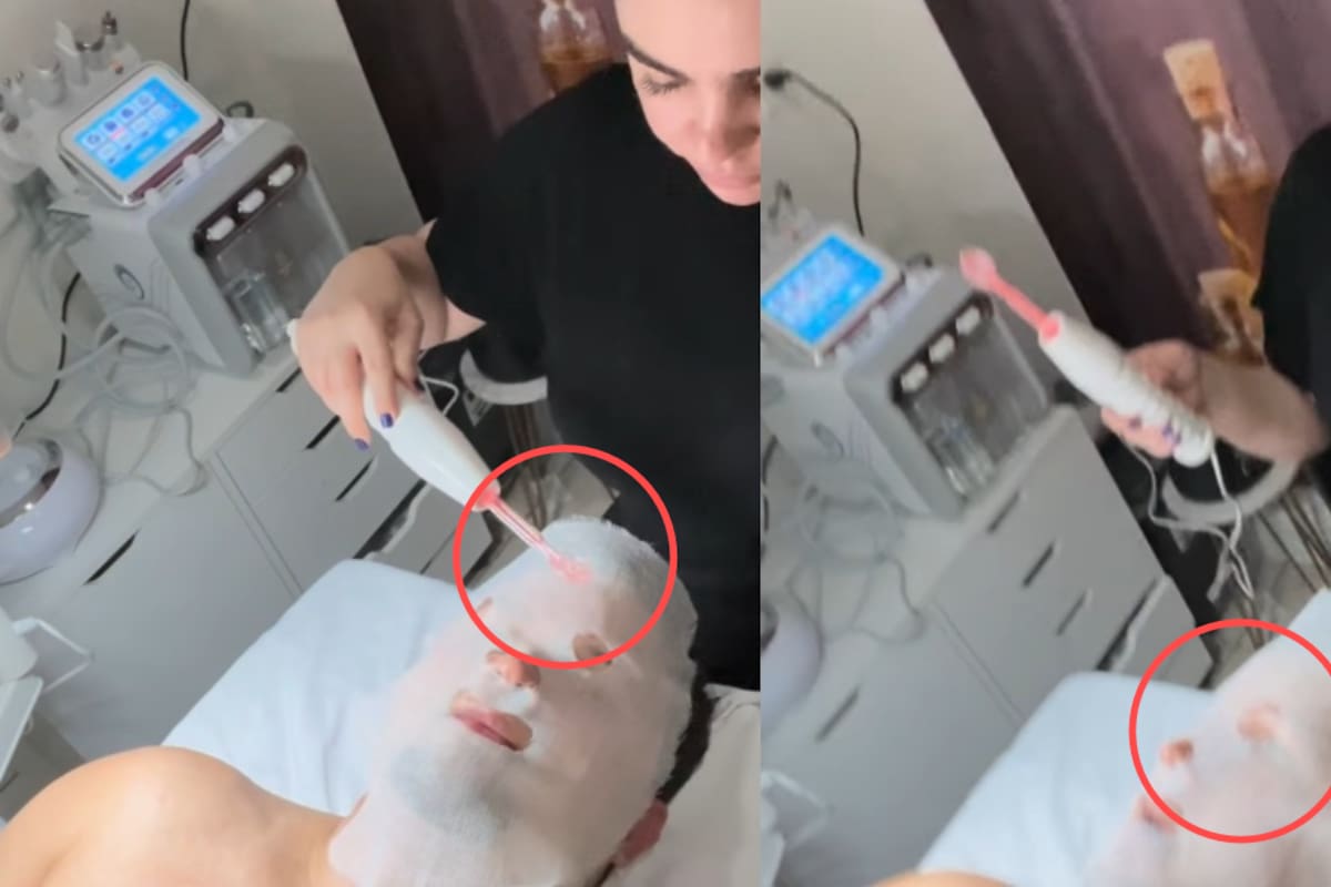 “Pero electrocútame”: hombre se vuelve viral en redes al hacerse un facial y pedir que le dieran toques en la cara