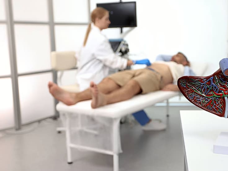 Los alimentos que ayudan a proteger y mantener sano el hígado