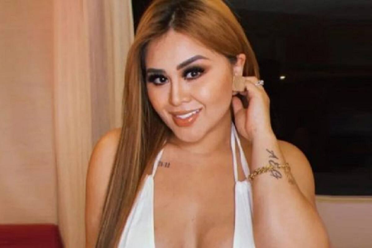 Gomita muestra el antes y después de sus operaciones