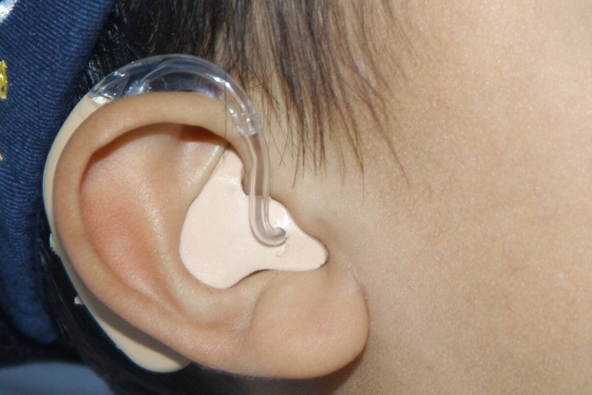 Renegados y Club de Leones realizarán jornada en apoyo a personas con problemas de audición