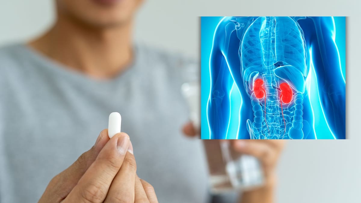 Este es el medicamento que más daña al riñón y lo usamos con frecuencia