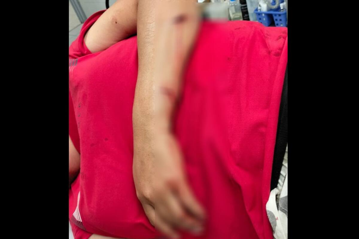 Mujer es atacada a machetazos en Los Algodones