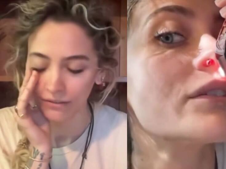 Hija de Michale Jackson revela las secuelas físicas de su adicción y advierte a los jóvenes sobre el consumo de drogas