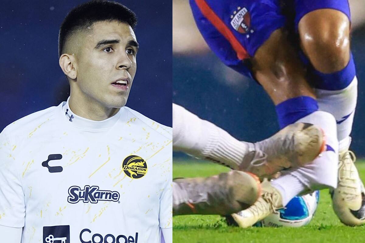 ¿Cuál será la sanción que tendrá el futbolista que lesionó al ‘Hobbit’ Bermúdez?